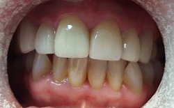 Natick Family Dental Natick Family Dental